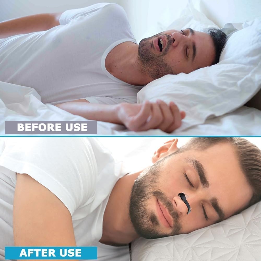 Premium Nasal Strips — شرائط الأنف للتنفس