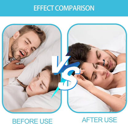 Premium Nasal Strips — شرائط الأنف للتنفس